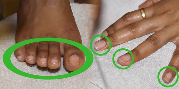 Partes da unha e fotos – dedo humano e dedo do pé