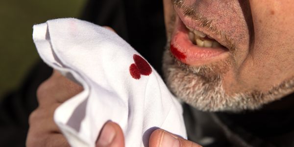 Sangue na boca – causas de sangramento da boca