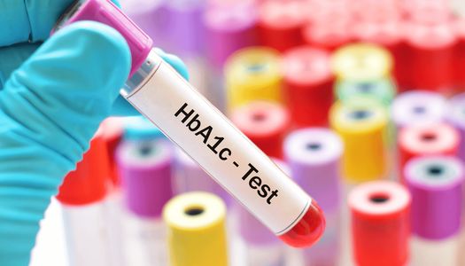 fatos sobre o teste de sangue HbA1C (A1C)