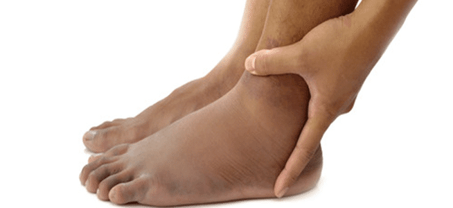 gravidez perna inchaço causas de pernas inchadas tornozelos pés