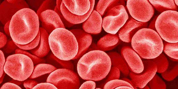 plaquetas sanguíneas altas de trombocitose