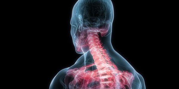 sinais de chicotada (tensão no pescoço) e síndrome de chicotada tardia