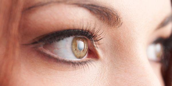sinais de olhos de catarata e como a catarata afeta a visão