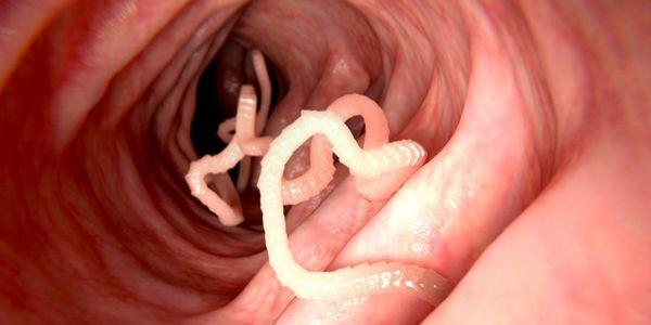 sintomas de vermes intestinais humanos retrata tratamento