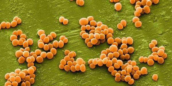 staphylococcus aureus coagolase negativo estafilococos